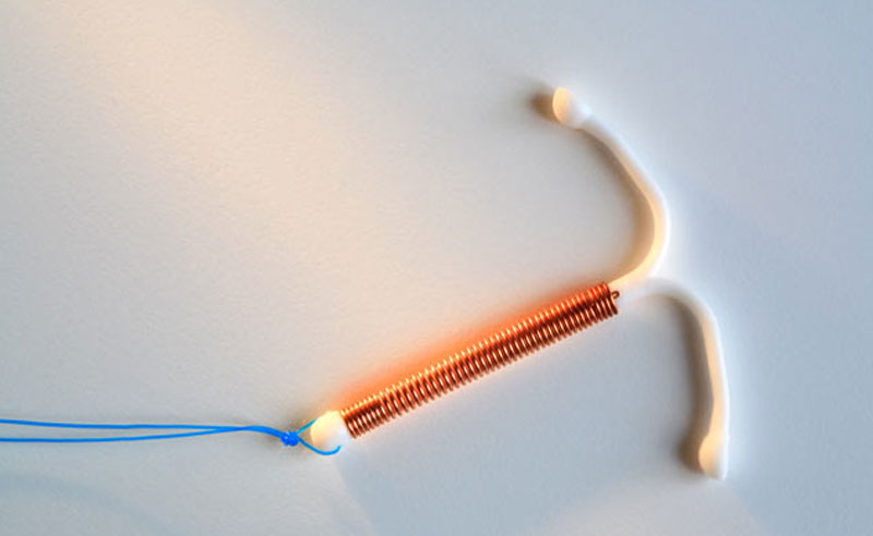 Everything You Need To Know About Iuds Society19 Everything You Need To Know About Iuds Society19